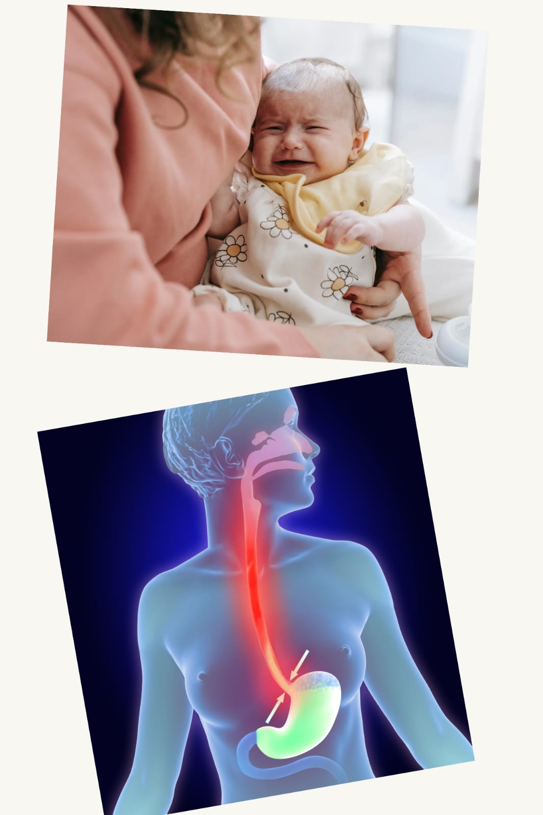 Bébé en pleurs dans les bras d'un parent avec schéma illustrant le reflux gastro-œsophagien (RGO) chez le nourrisson.